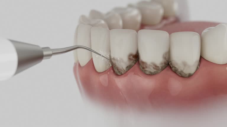 Trusted Dental Implants service in San Pablo, CA - Dentist Open Now